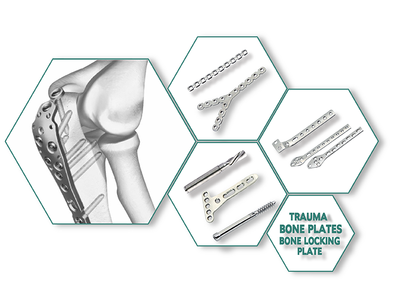 Orthopaedic Implants